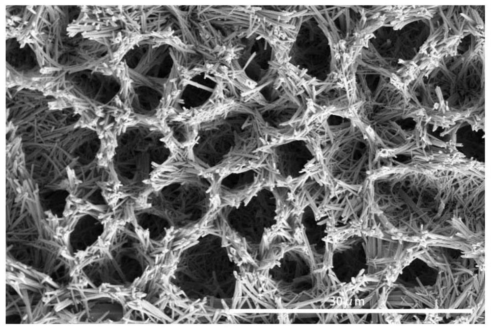 A kind of injectable paclitaxel gel with high drug load and its preparation method and application