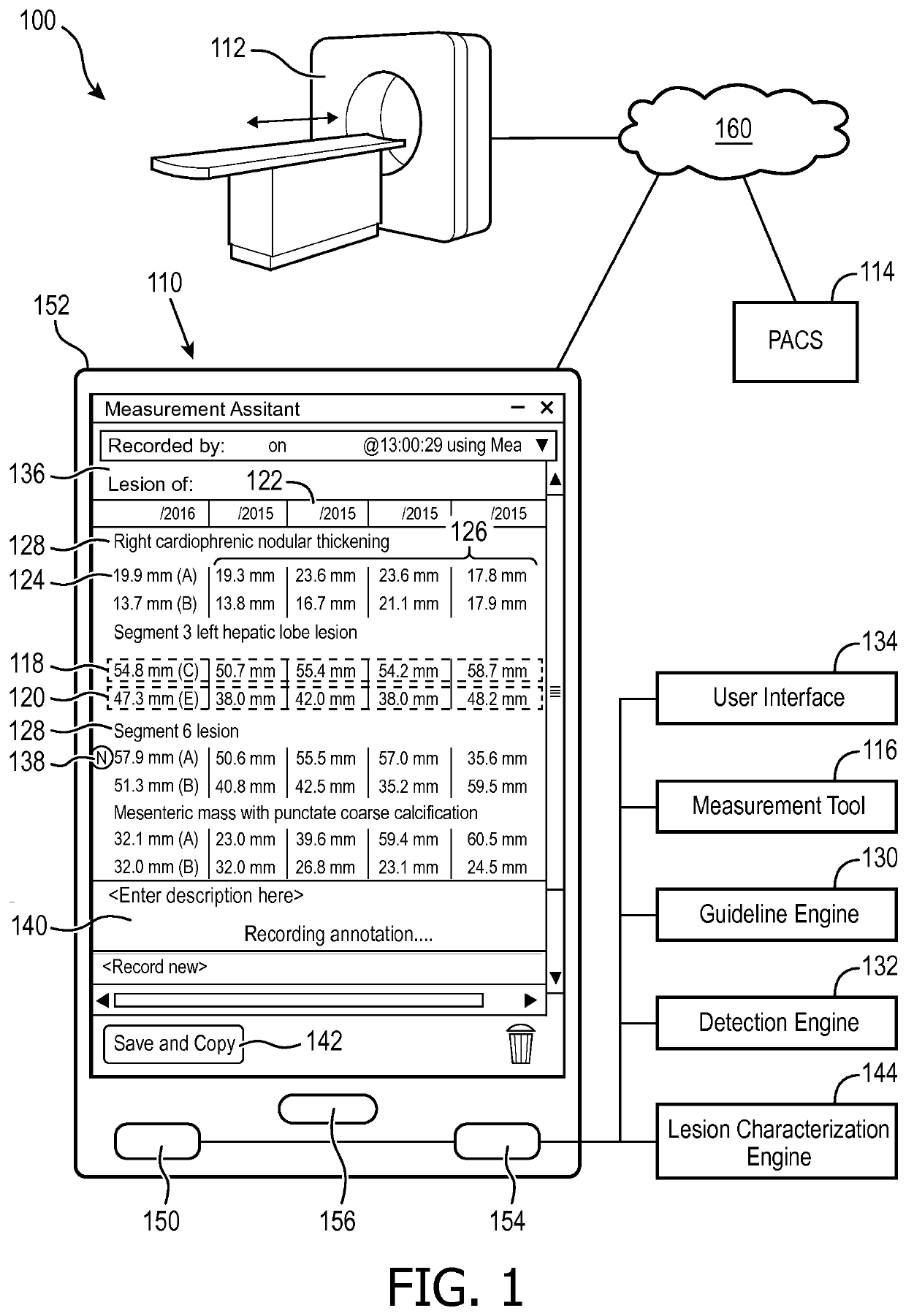 Tumor tracking with intelligent tumor size change notice