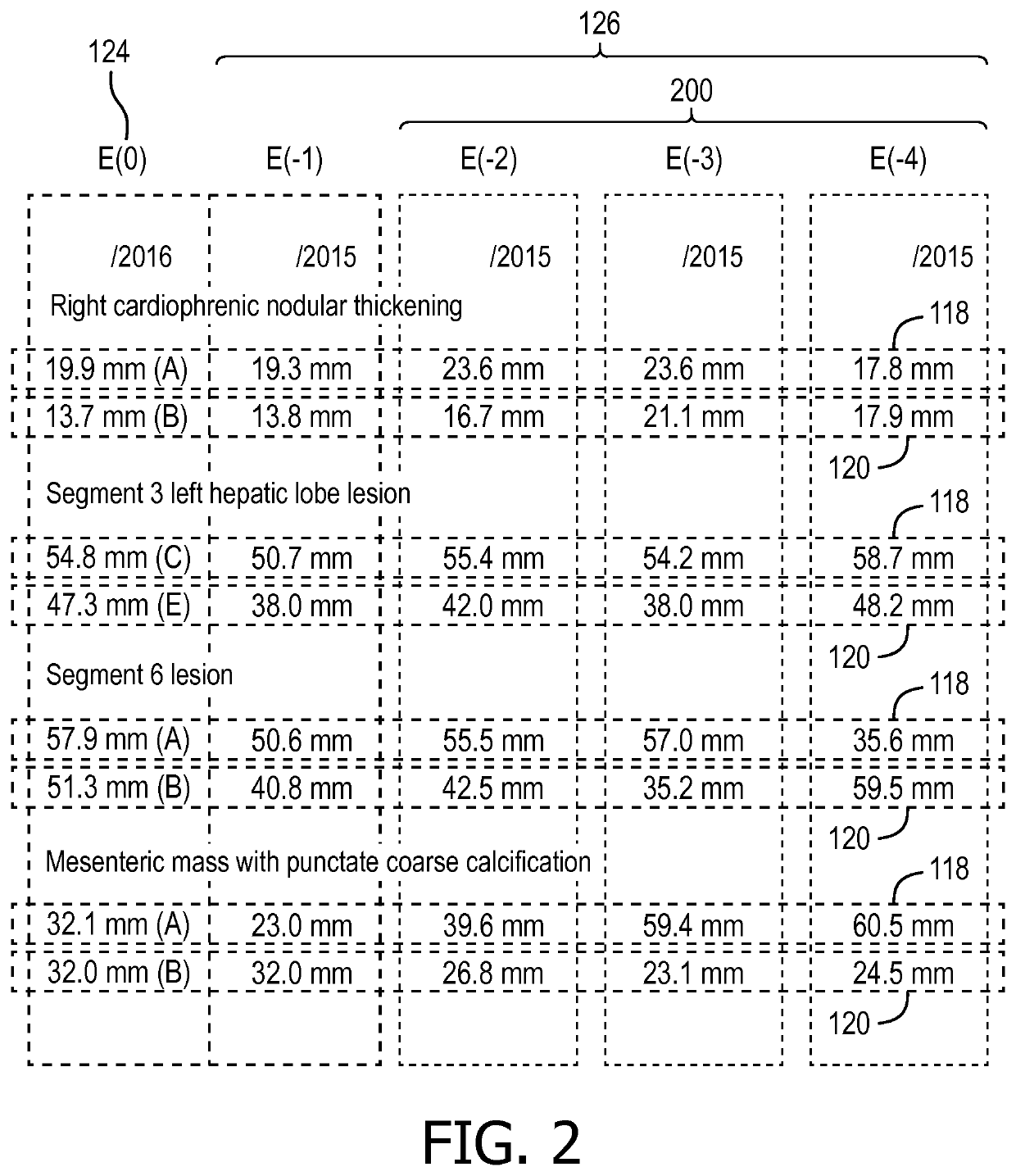 Tumor tracking with intelligent tumor size change notice