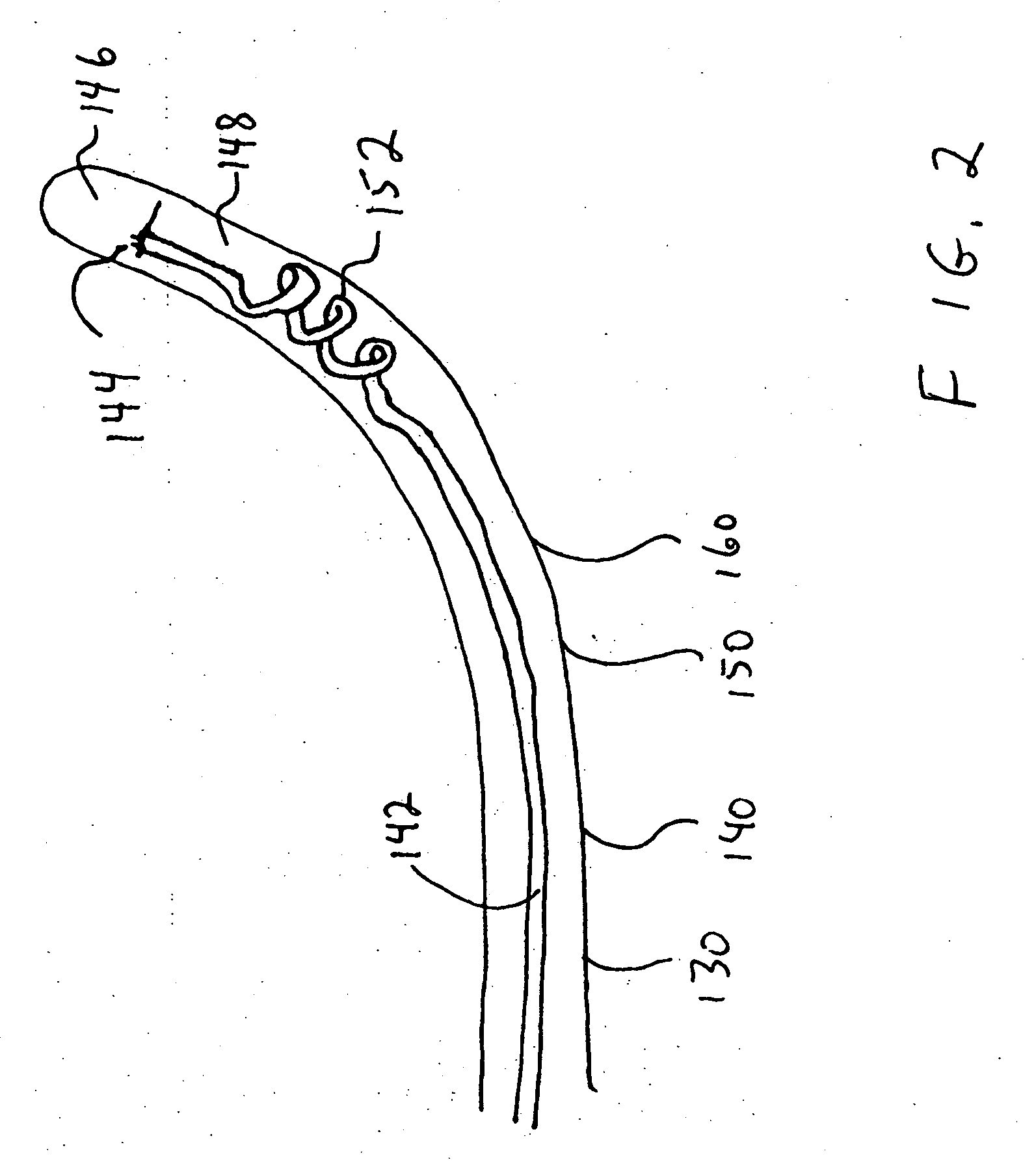 Endometrial ablation device and method