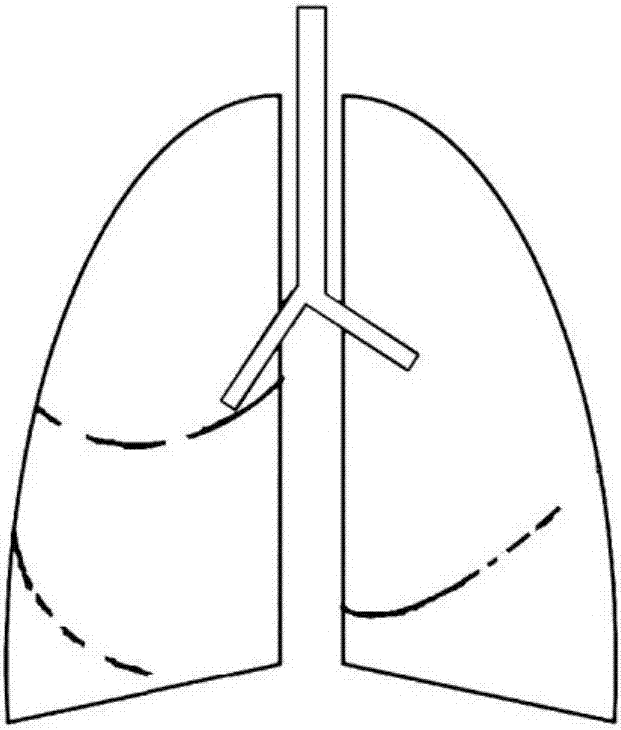 Lung fissure integrity assessment method, device and system