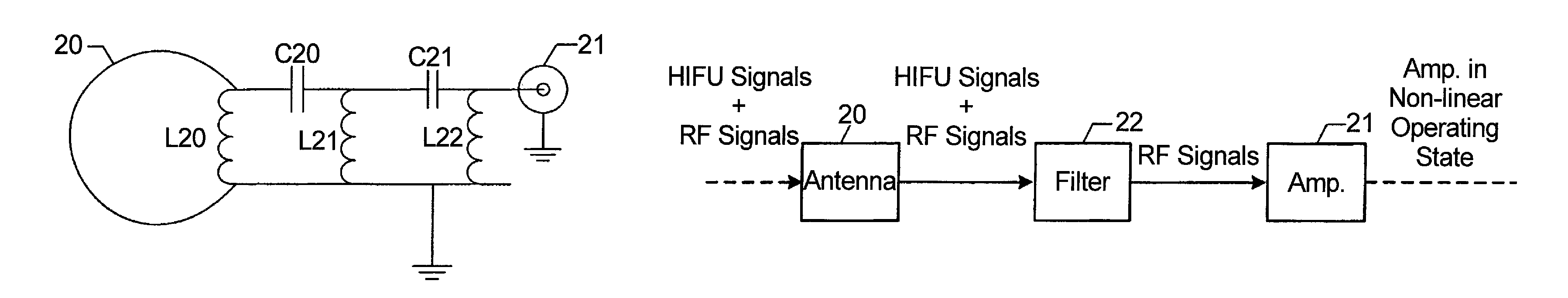 HIFU-compatible reception coil for MRI RF signals and signal receiving method