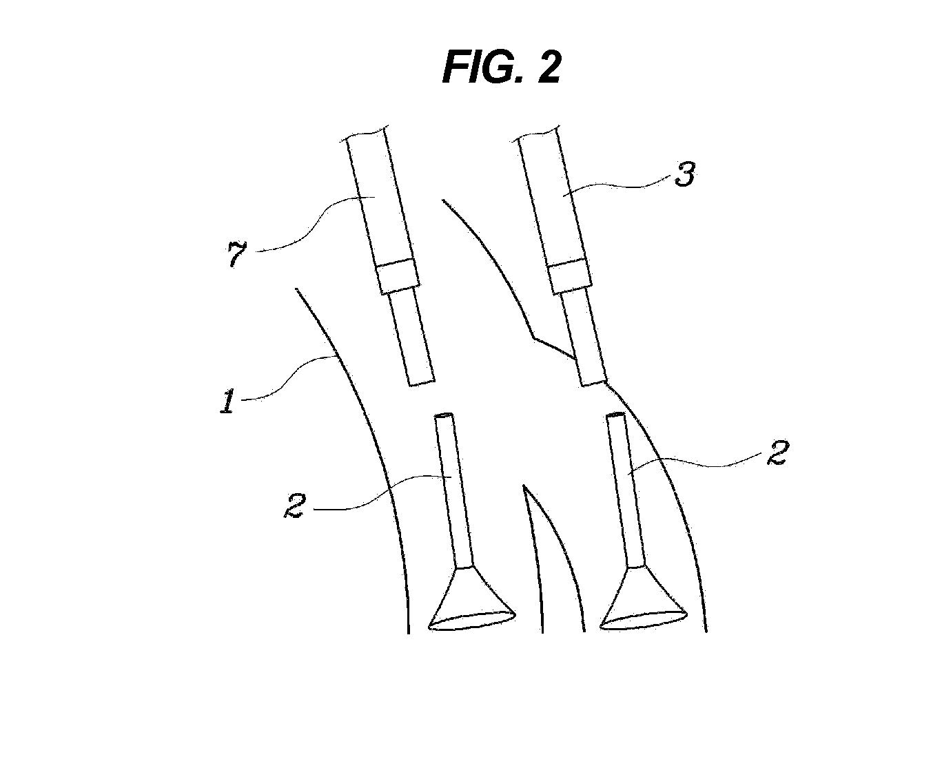 Injection system for cold start improvement of flexible-fuel vehicle and method of controlling the same