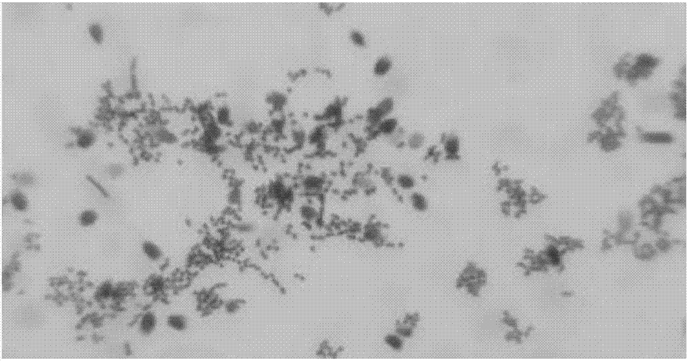Method for preparing microbial ecological agent for treating infertility