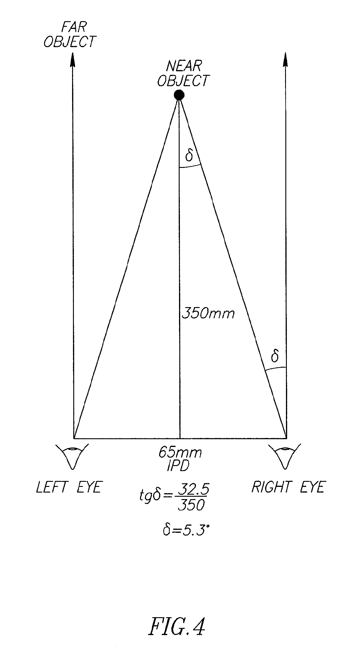Method and system for treatment of visual impairment