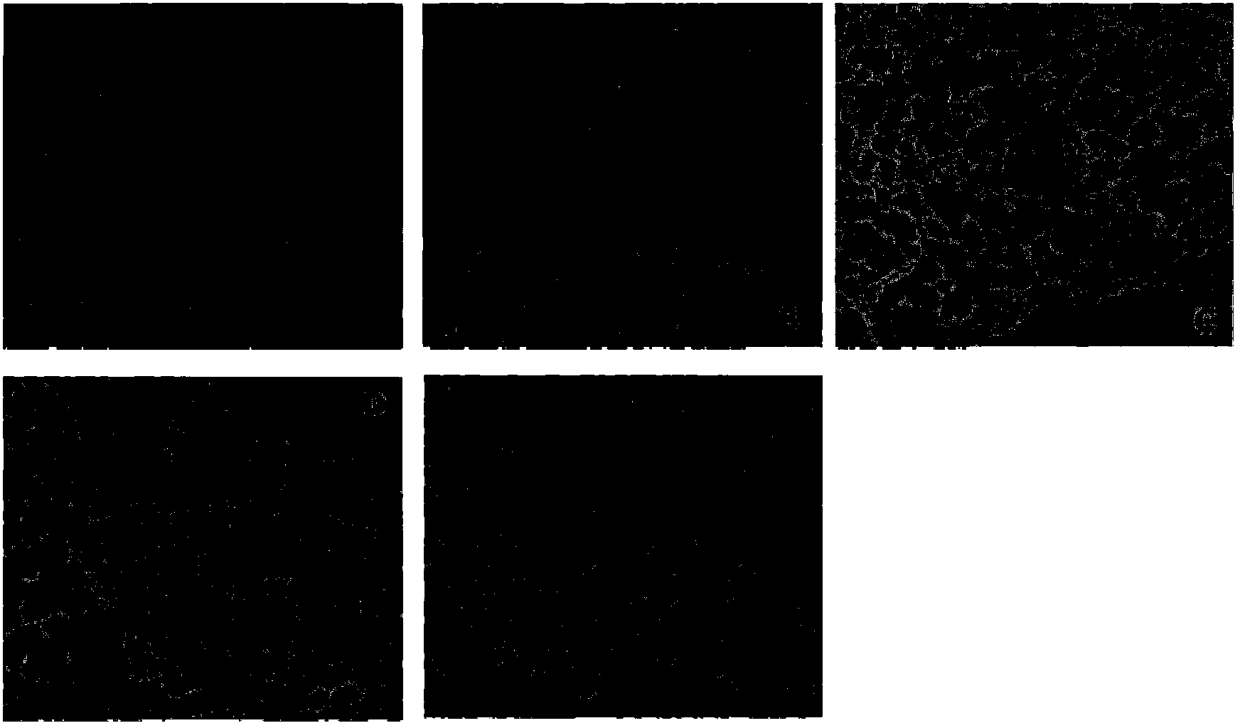 Method of using rhein for treating fibrotic conditions and tumors