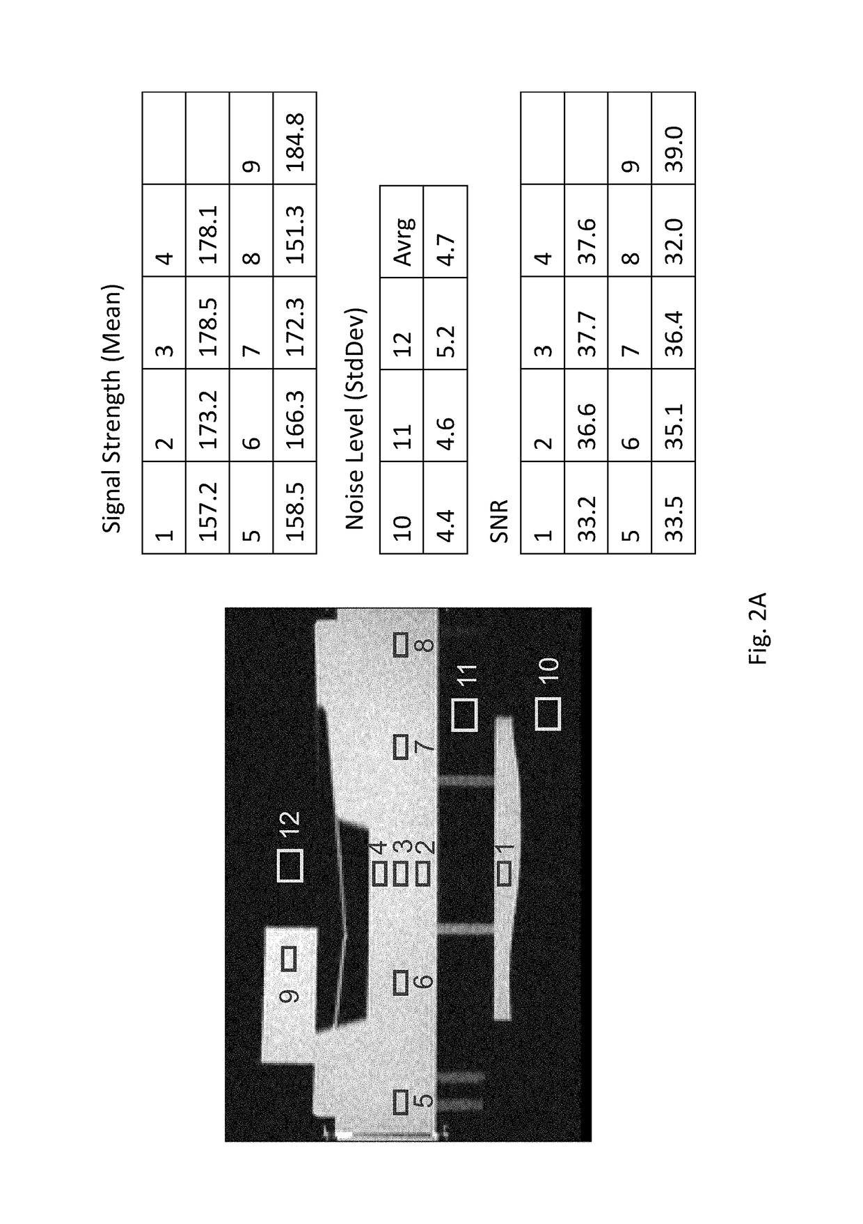 Apparatus for Improving Magnetic Resonance Imaging