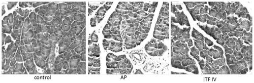 Long-chain inulin regulates acute pancreatic inflammation and its associated tissue damage