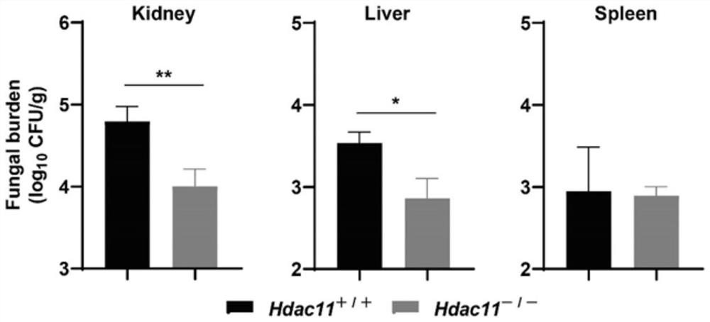 Application of histone deacetylase HDAC11 inhibitor in preparation of medicine for preventing and treating fungal infection