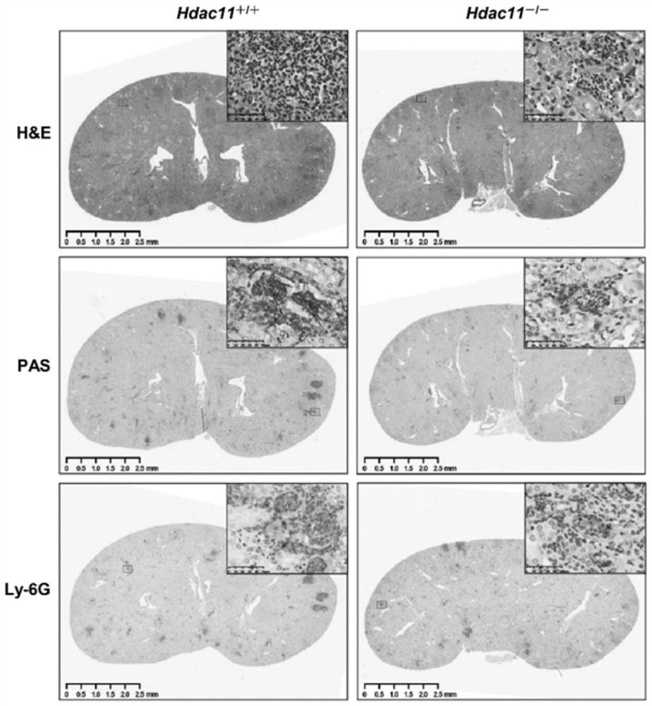 Application of histone deacetylase HDAC11 inhibitor in preparation of medicine for preventing and treating fungal infection