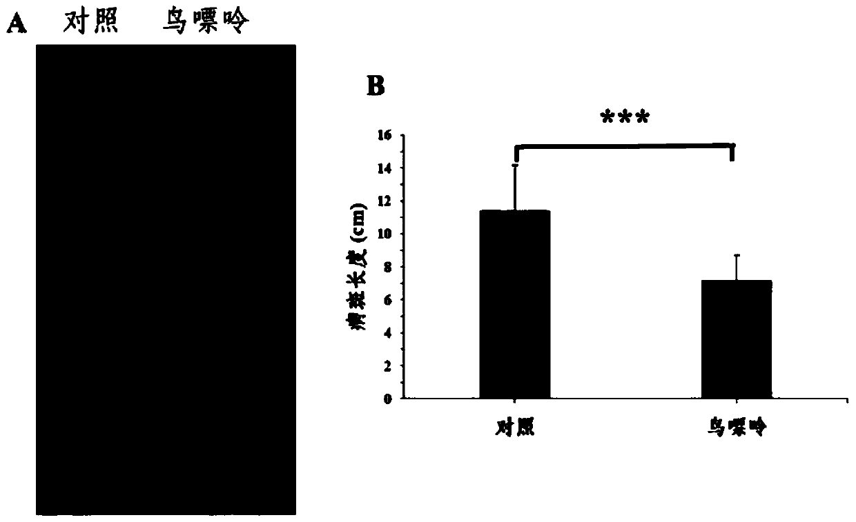 Purine alkali plant immune resistance inducer and application thereof