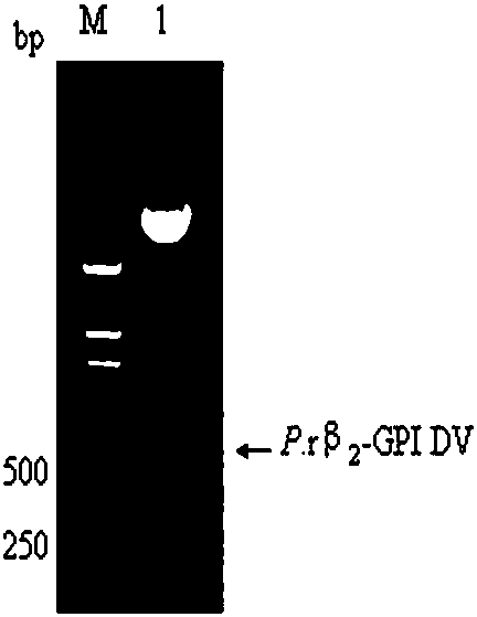 Yeast recombinant expression, purification and application of a protein functional polypeptide with the effect of preventing and treating atherosclerosis