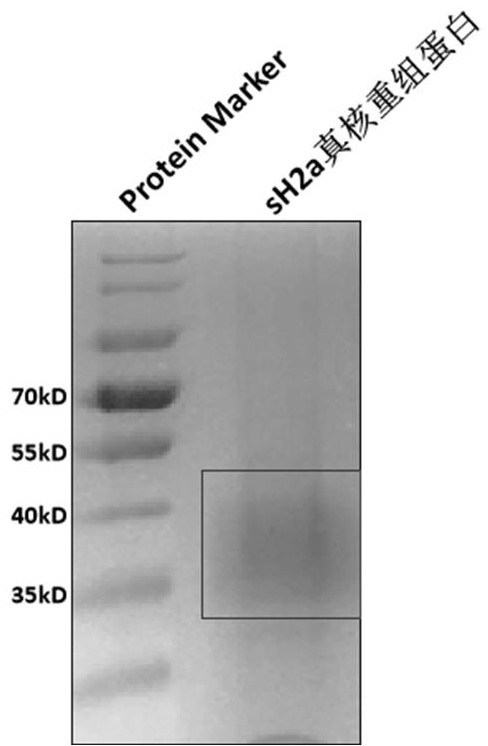 Application of asialoglycoprotein receptor fragment sh2a as a marker