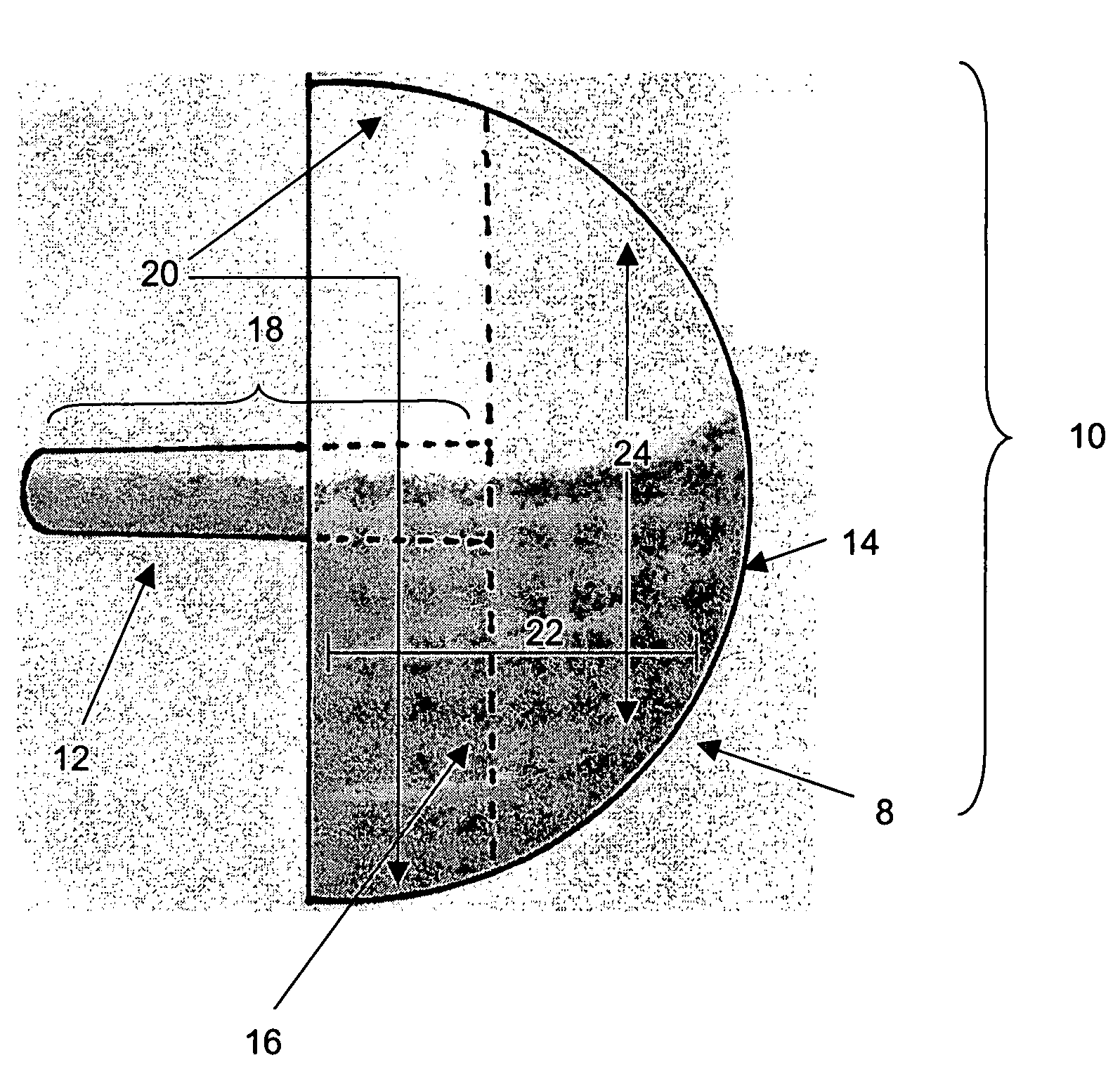 Humeral head resurfacing implant and methods of use thereof