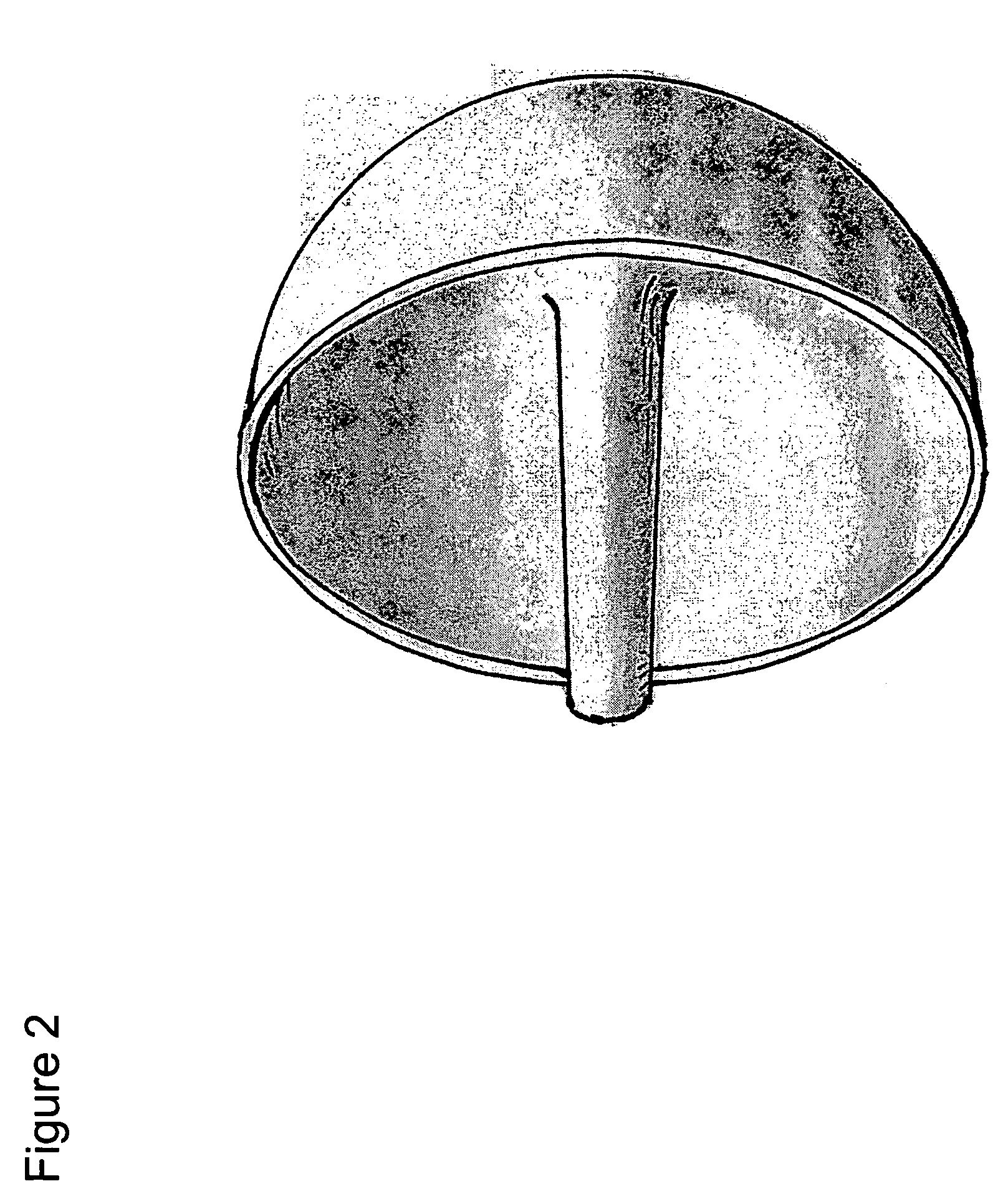 Humeral head resurfacing implant and methods of use thereof