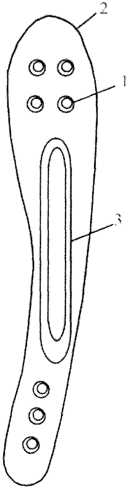 Anatomical humerus bridge-type bone fracture plate