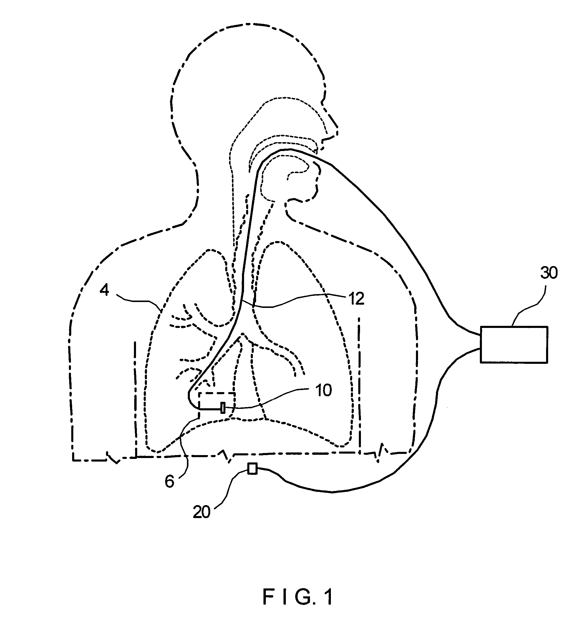 Devices and methods for tissue analysis