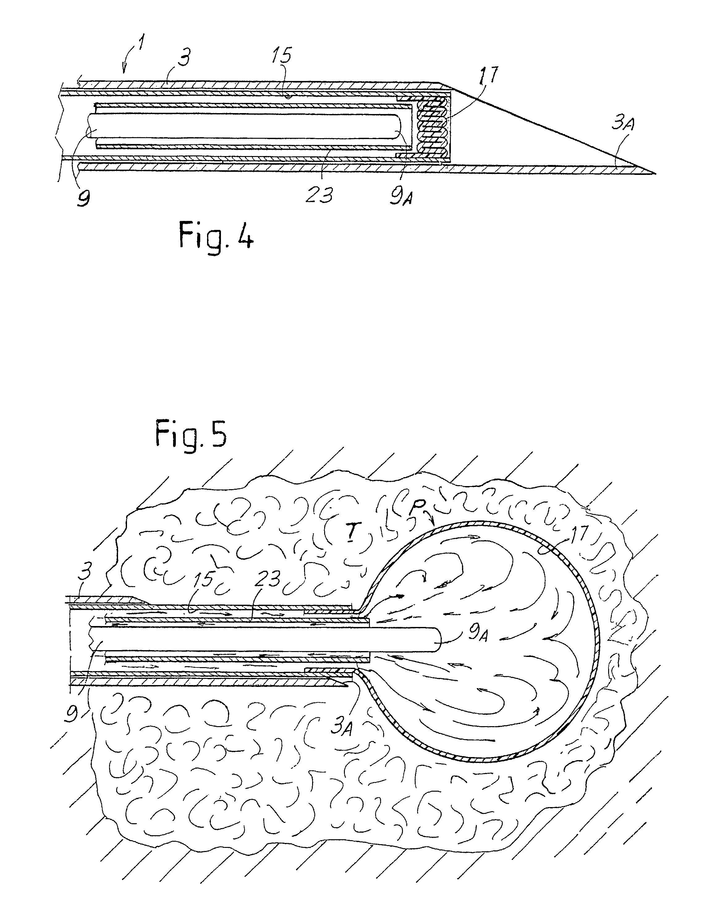 Device and equipment for treating tumors by laser thermotherapy