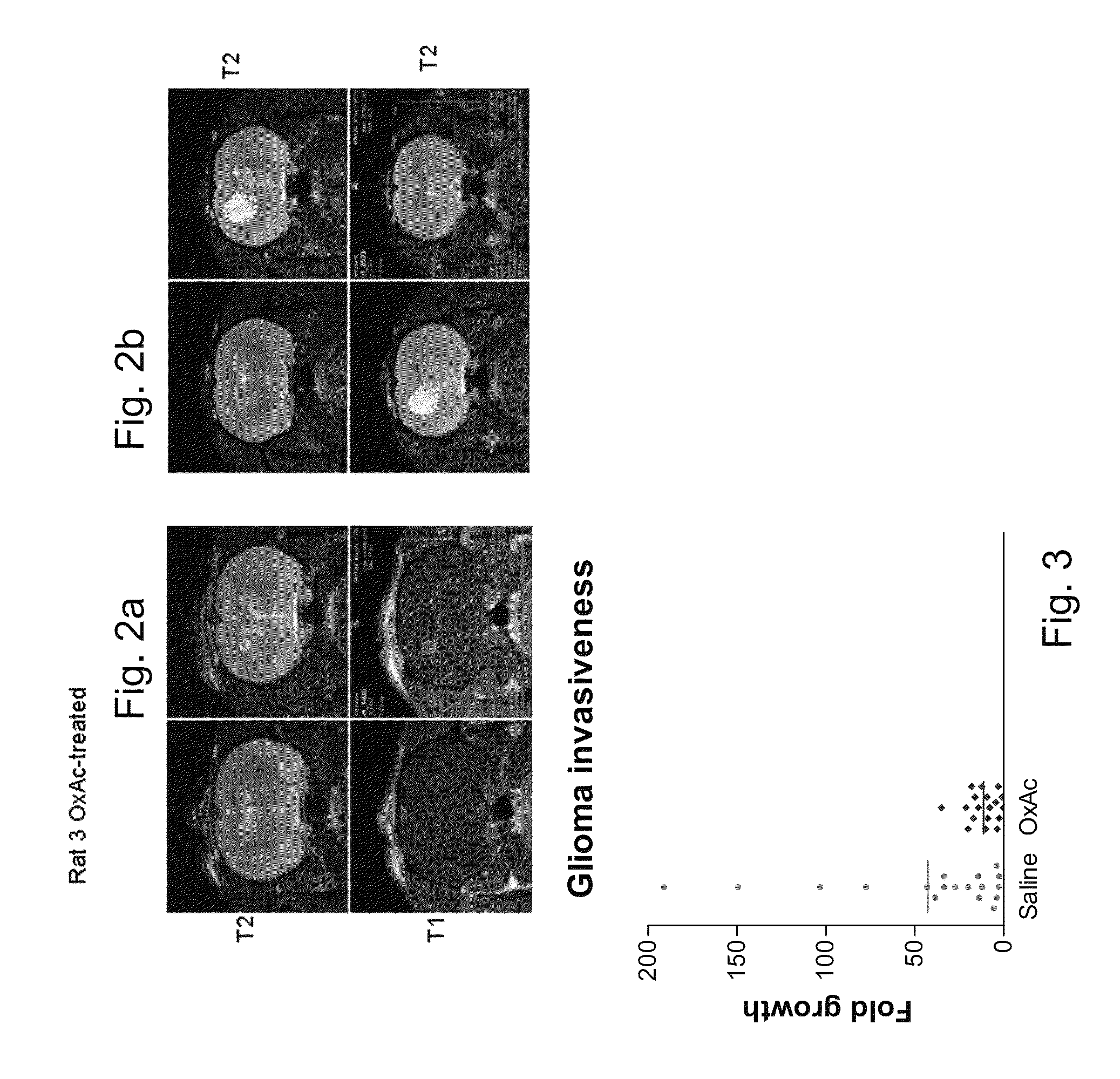 Methods of treating cancer of the central nervous system