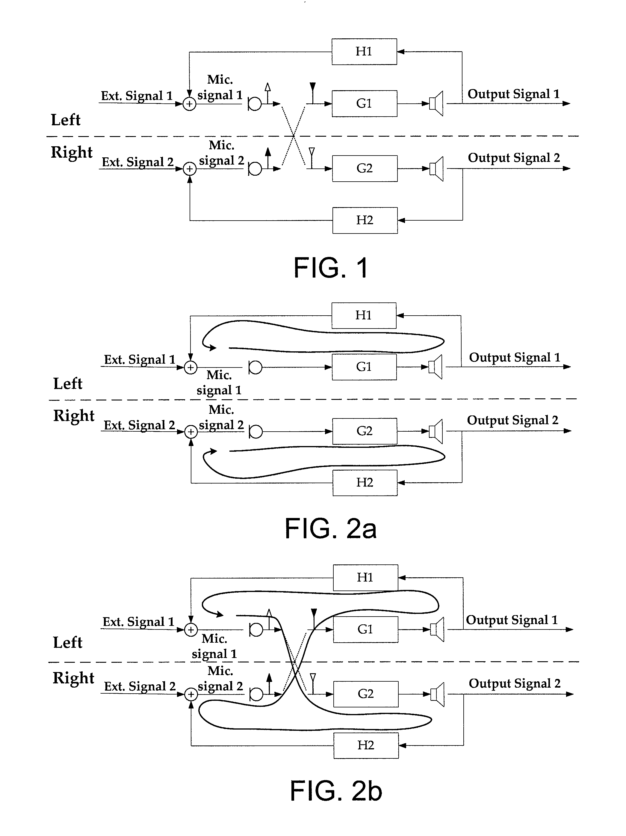System for reducing acoustic feedback in hearing aids using inter-aural signal transmission, method and use