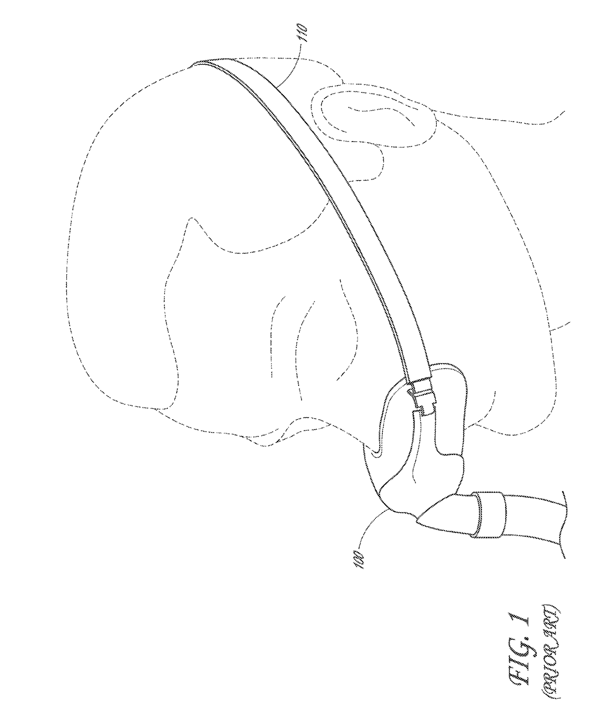 Headgear for a respiratory mask