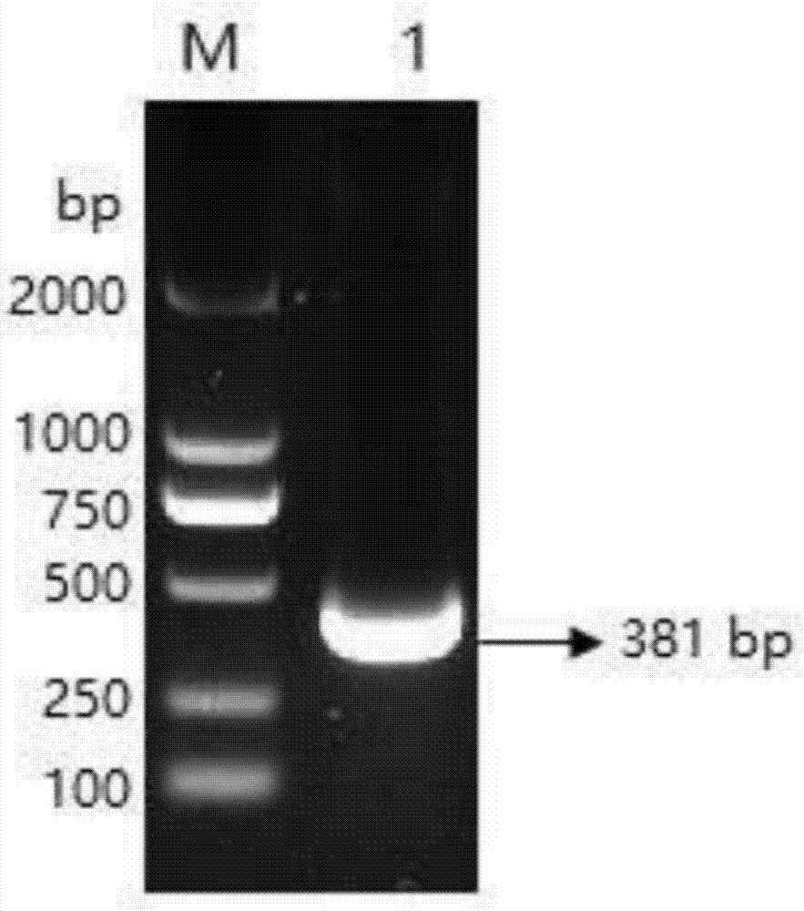 Recombinant expression protein of 1301 ORF136 genes of herpesvirus cyprinid type 3, antibody and application of antibody