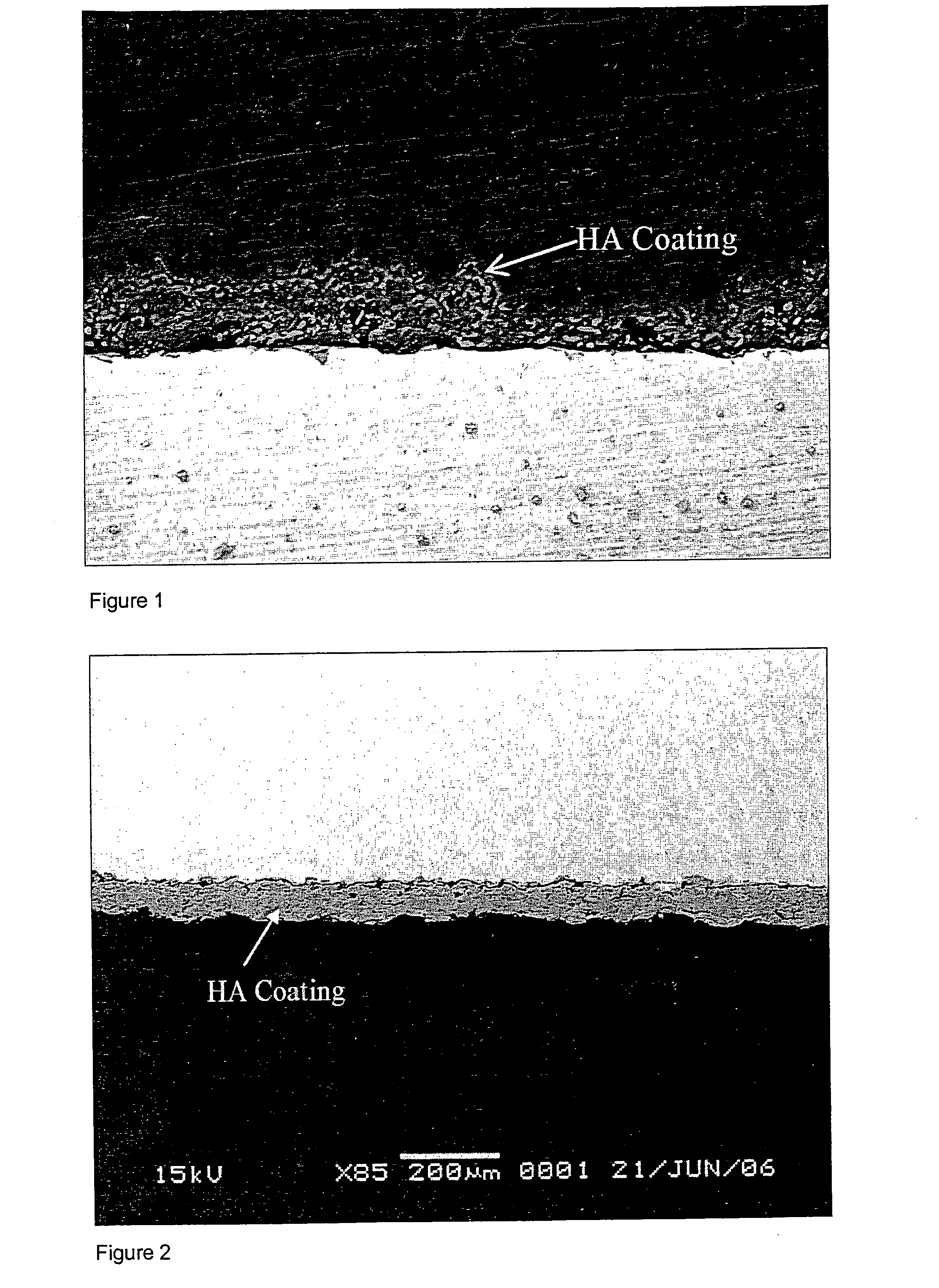 Article and a method of surface treatment of an article