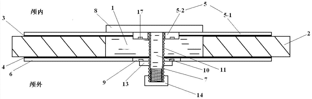 A device for repairing skull base defects