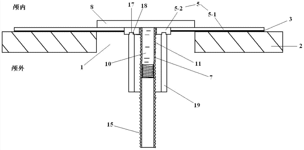 A device for repairing skull base defects