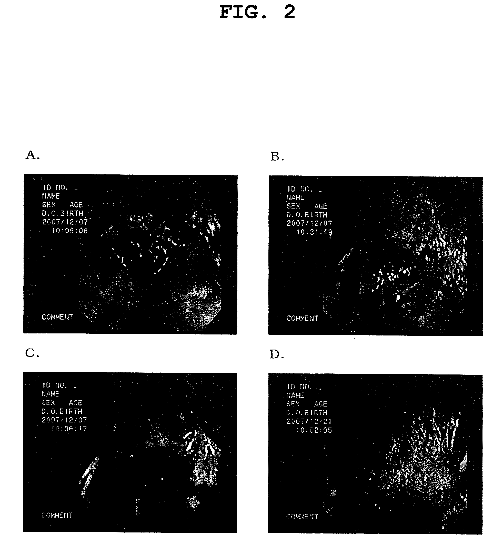 Agent for regenerating tympanic membrane or external auditory canal