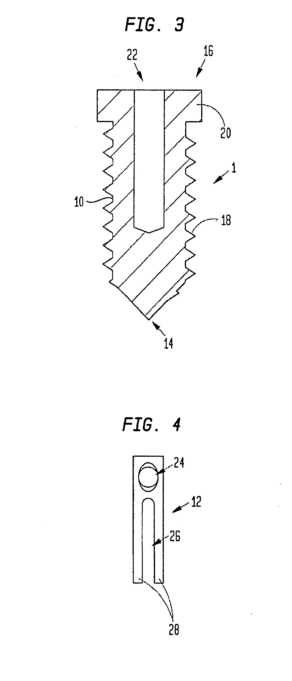 Medical device and procedure for attaching tissue to bone