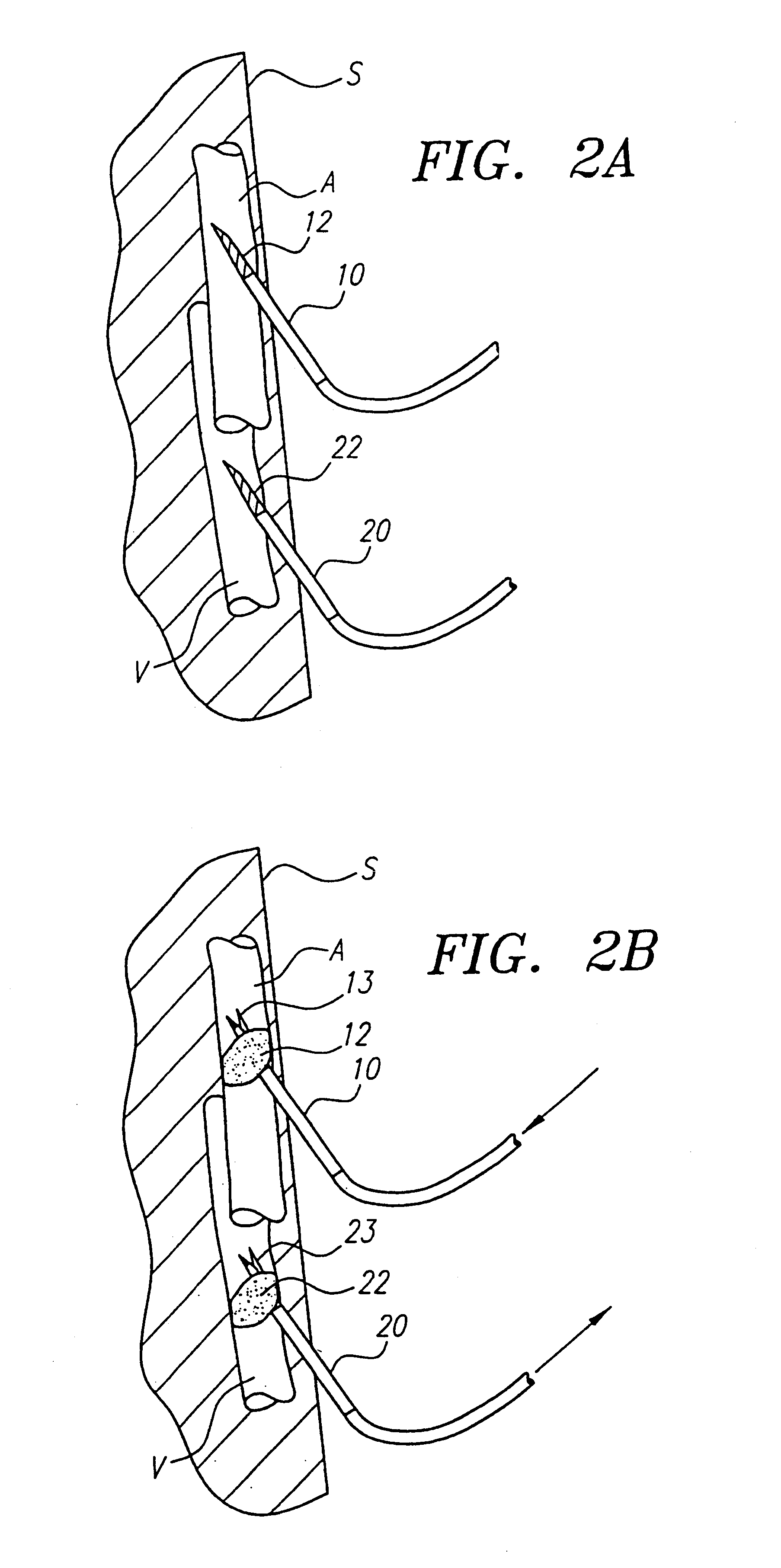Method and system for selective or isolated integrate cerebral perfusion and cooling