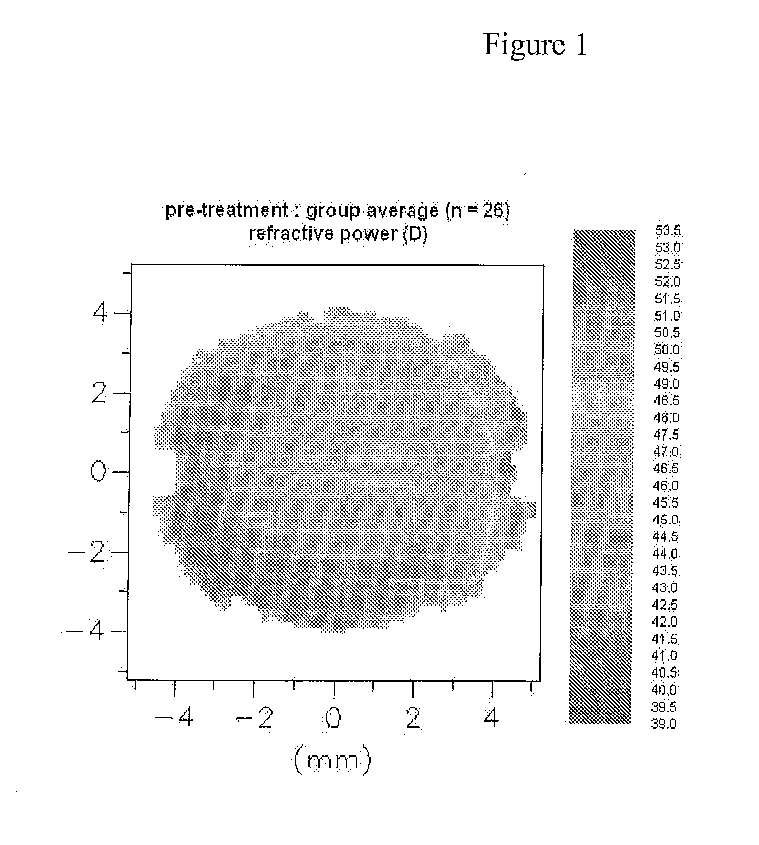 Design of myopia control ophthalmic lenses