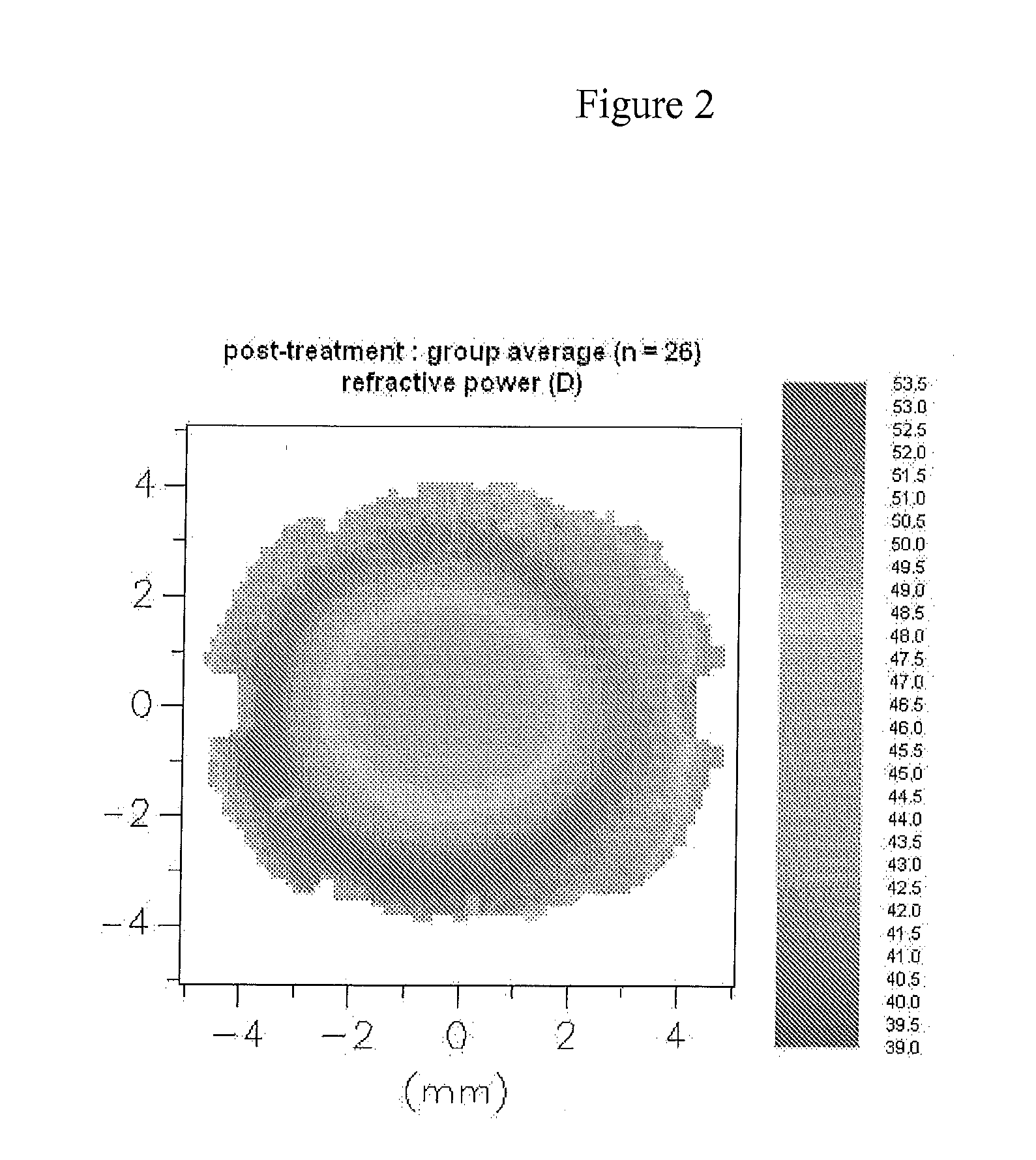 Design of myopia control ophthalmic lenses