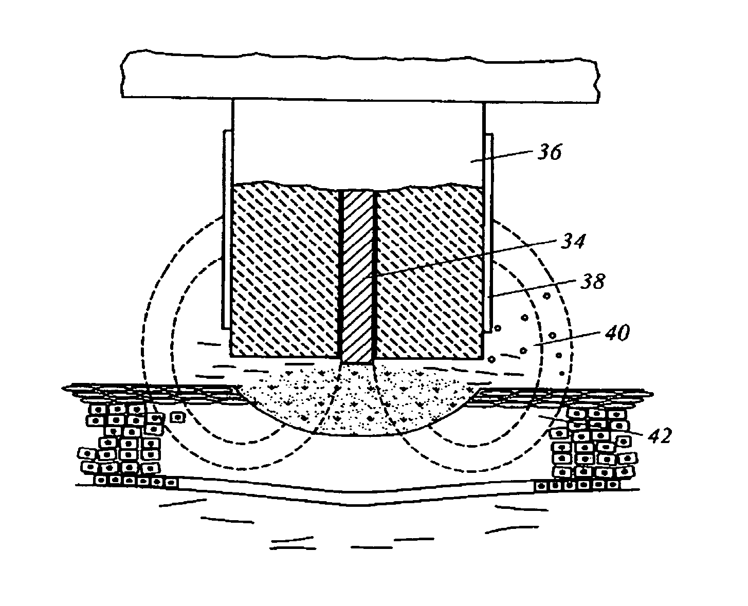 Electrosurgical method and system for treating foot ulcer