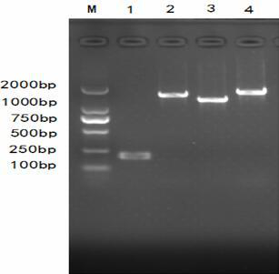 Preparation and applications for mycobacterium tuberculosis PUP protein overexpression strains