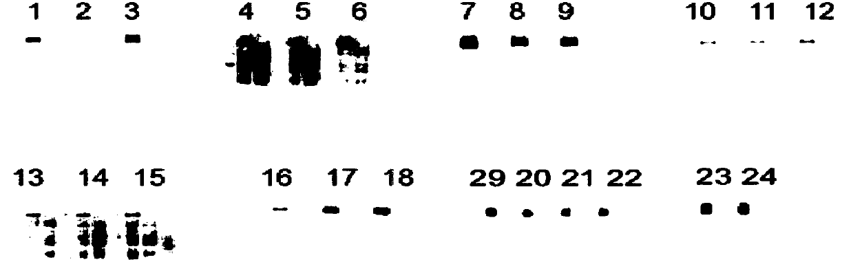 Anti-CD56-antibody and aplysiatoxin coupled composite, and preparation method and application thereof