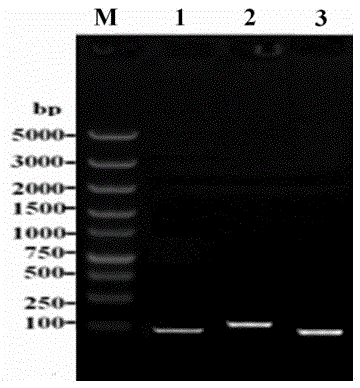 Triple real-time fluorescent quantitative PCR (polymerase chain reaction) detection method of three simian retroviruses