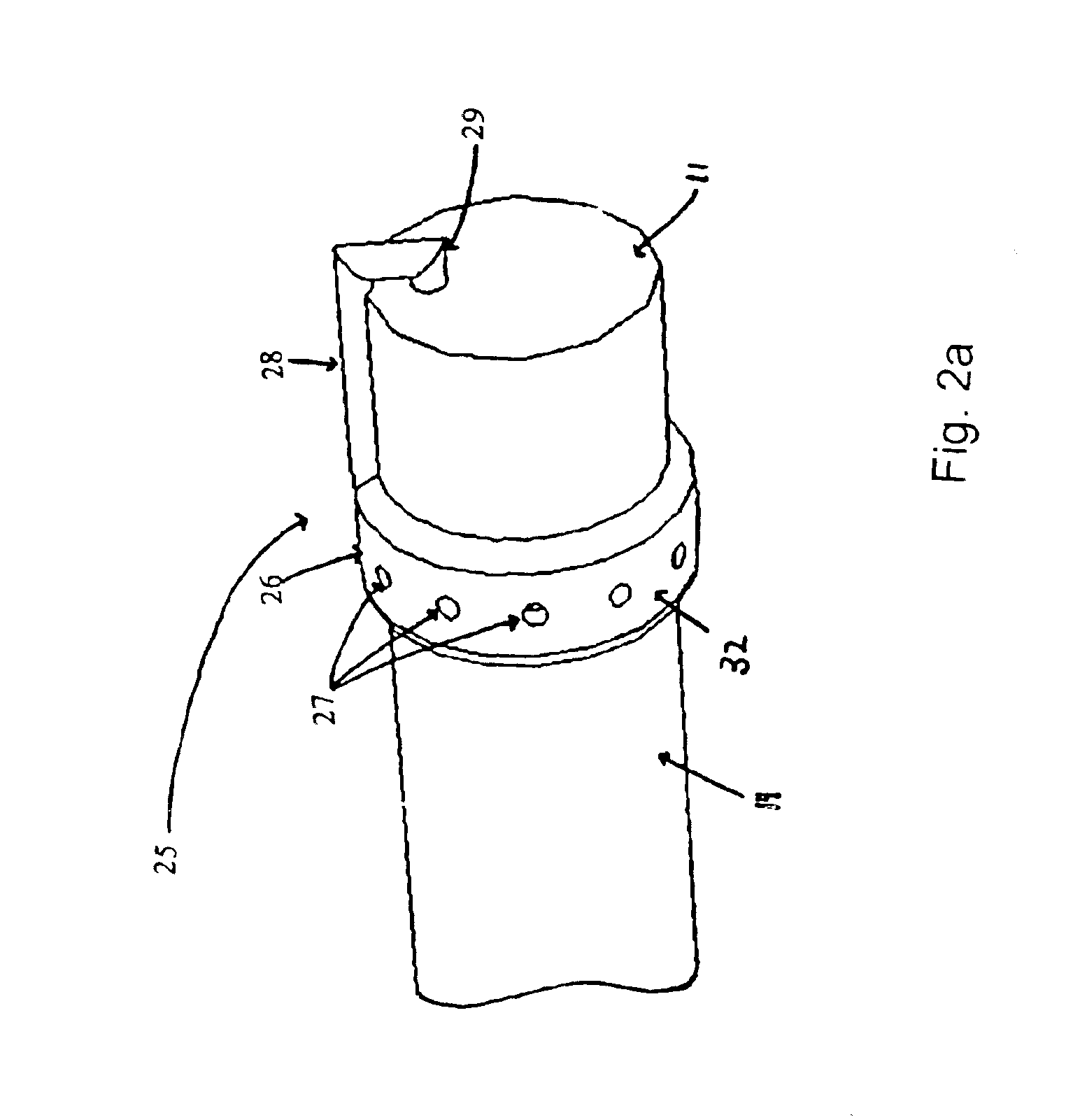 Systems and methods for providing gastrointestinal pain management