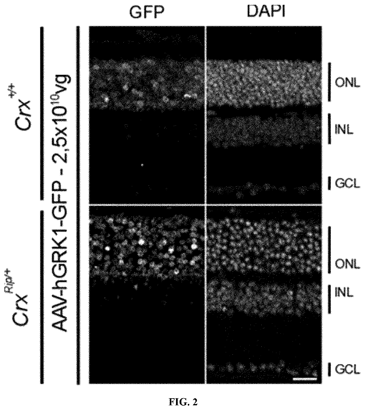 Improved therapeutic method for rare ocular diseases by gene replacement