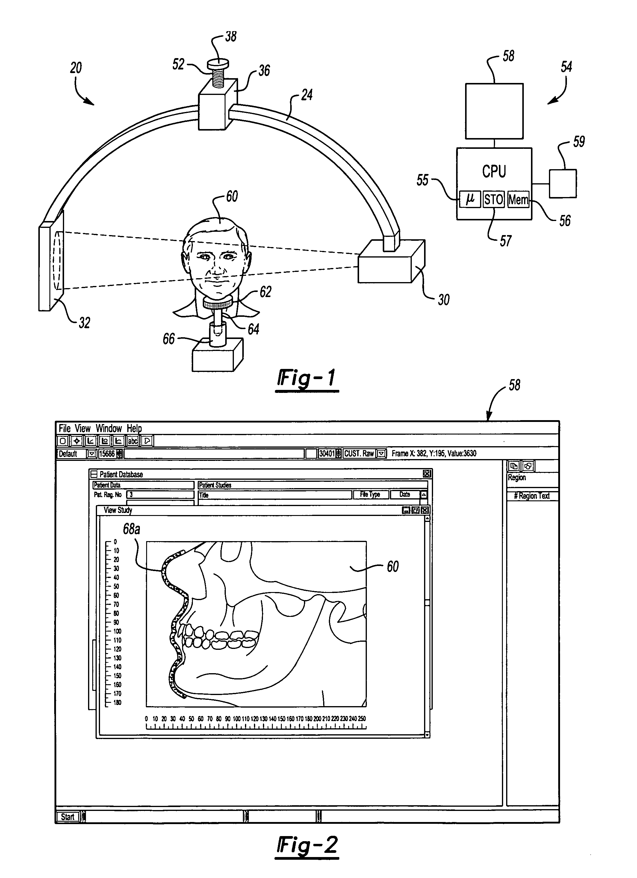 CT scanner system and method for improved positioning