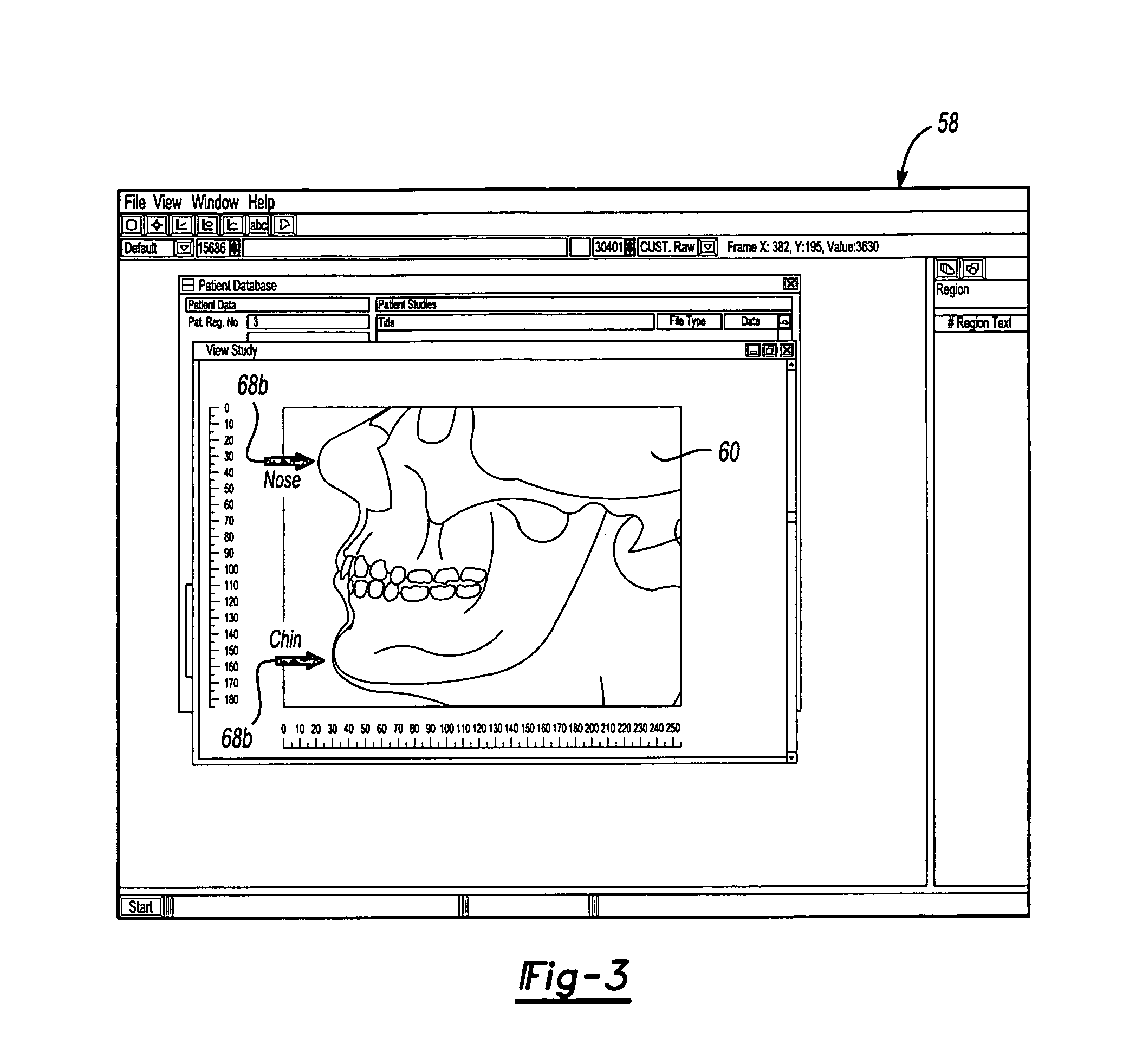 CT scanner system and method for improved positioning