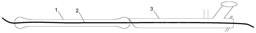 Ureteral stent tube for relieving mucosal lesion and implantation method thereof