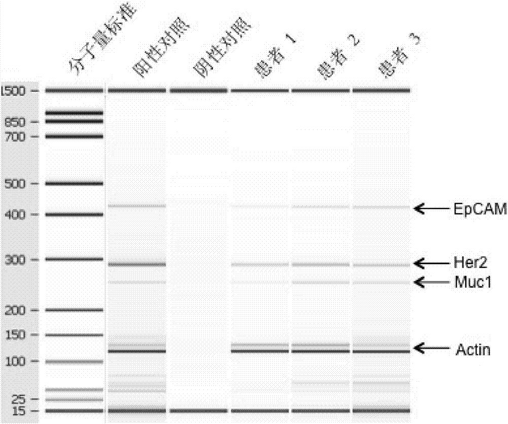 Kit for detecting markers of ovarian cancer cells in peripheral blood