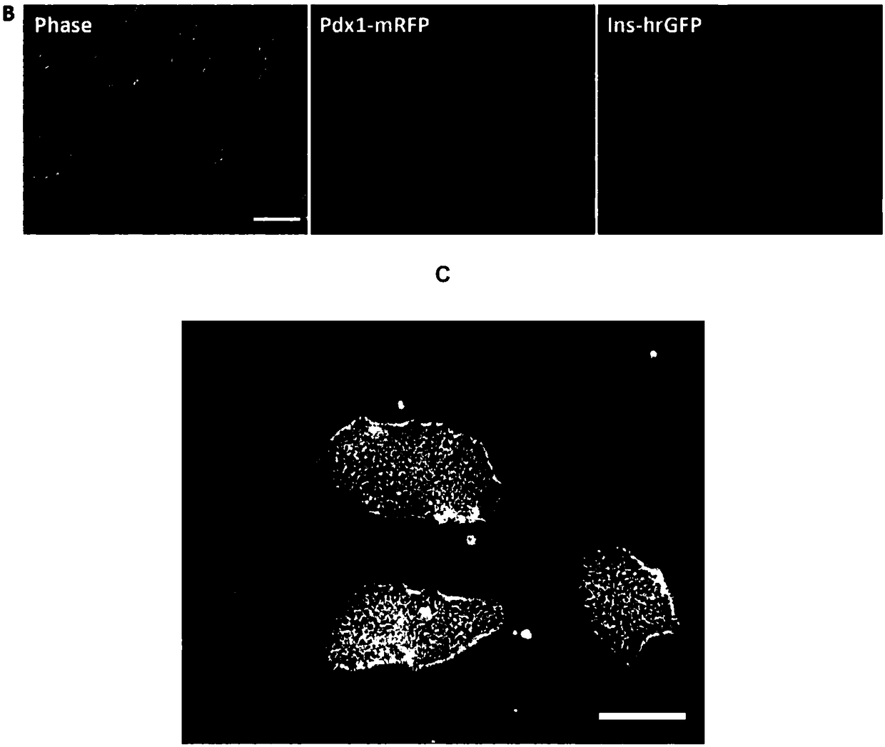 Construction and application of induced pluripotent stem cell line for expressing Pdx1/insulin double reporting genes