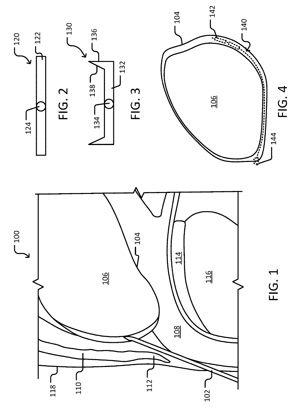 Systems and methods for implantable devices