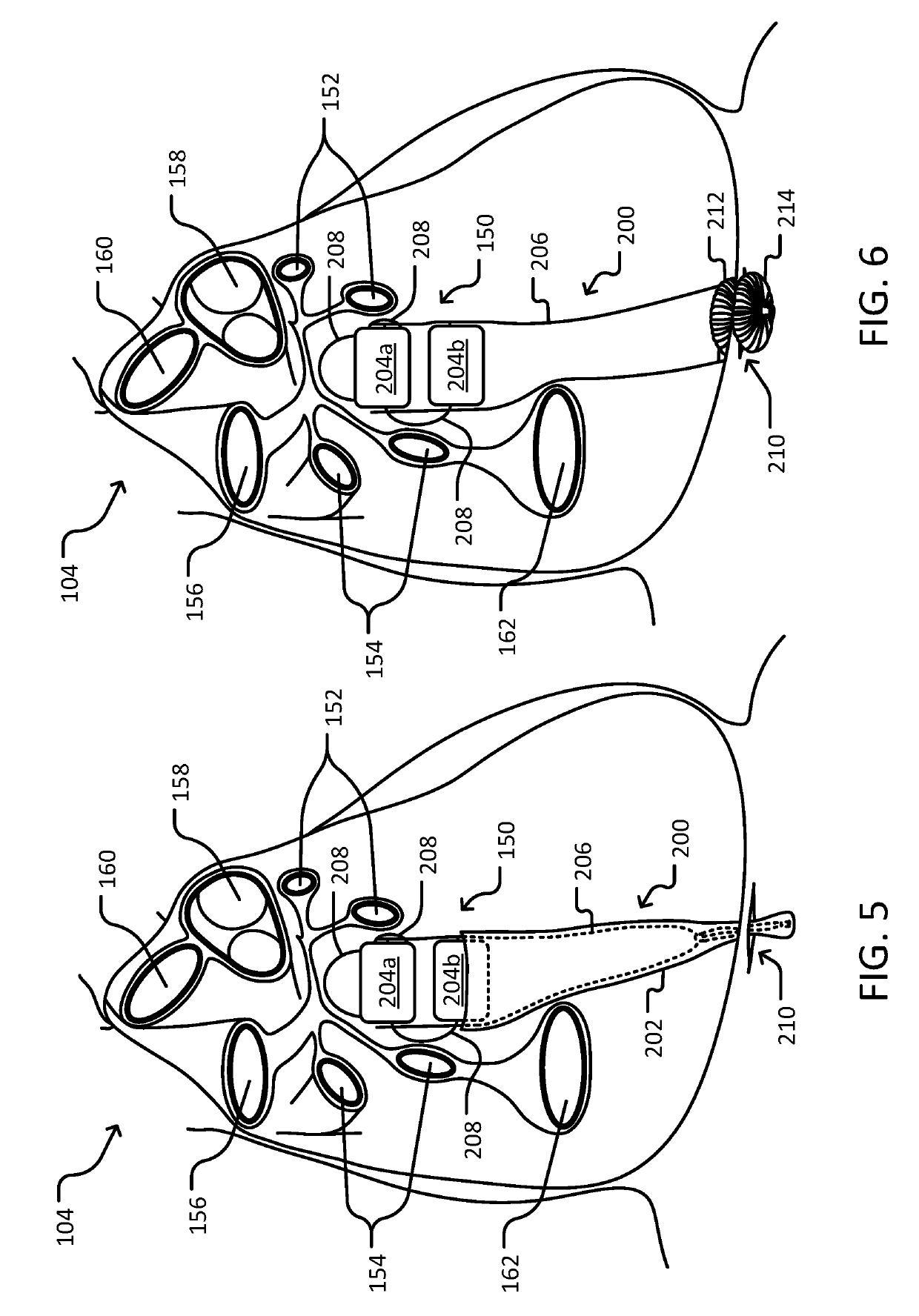 Systems and methods for implantable devices