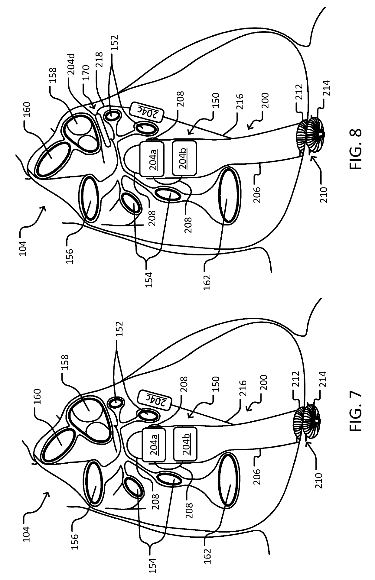 Systems and methods for implantable devices