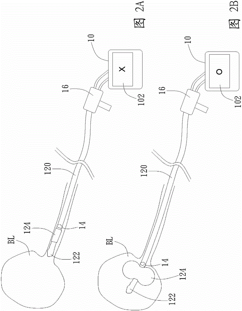 Catheter apparatus and operating method thereof