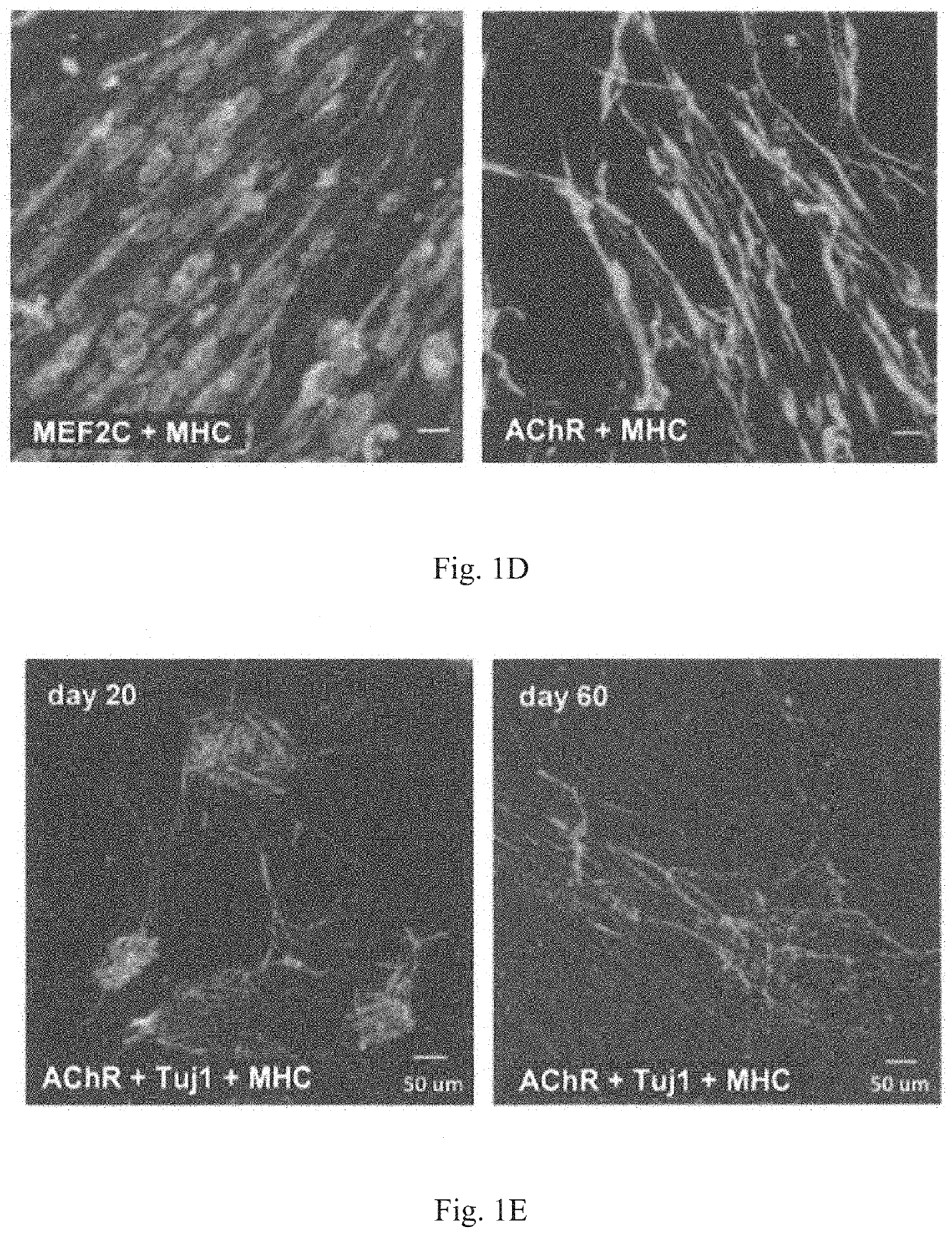 Method for obtaining artificial neuromuscular junction from pluripotent stem cells